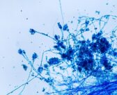 Fungus with fungicide properties found